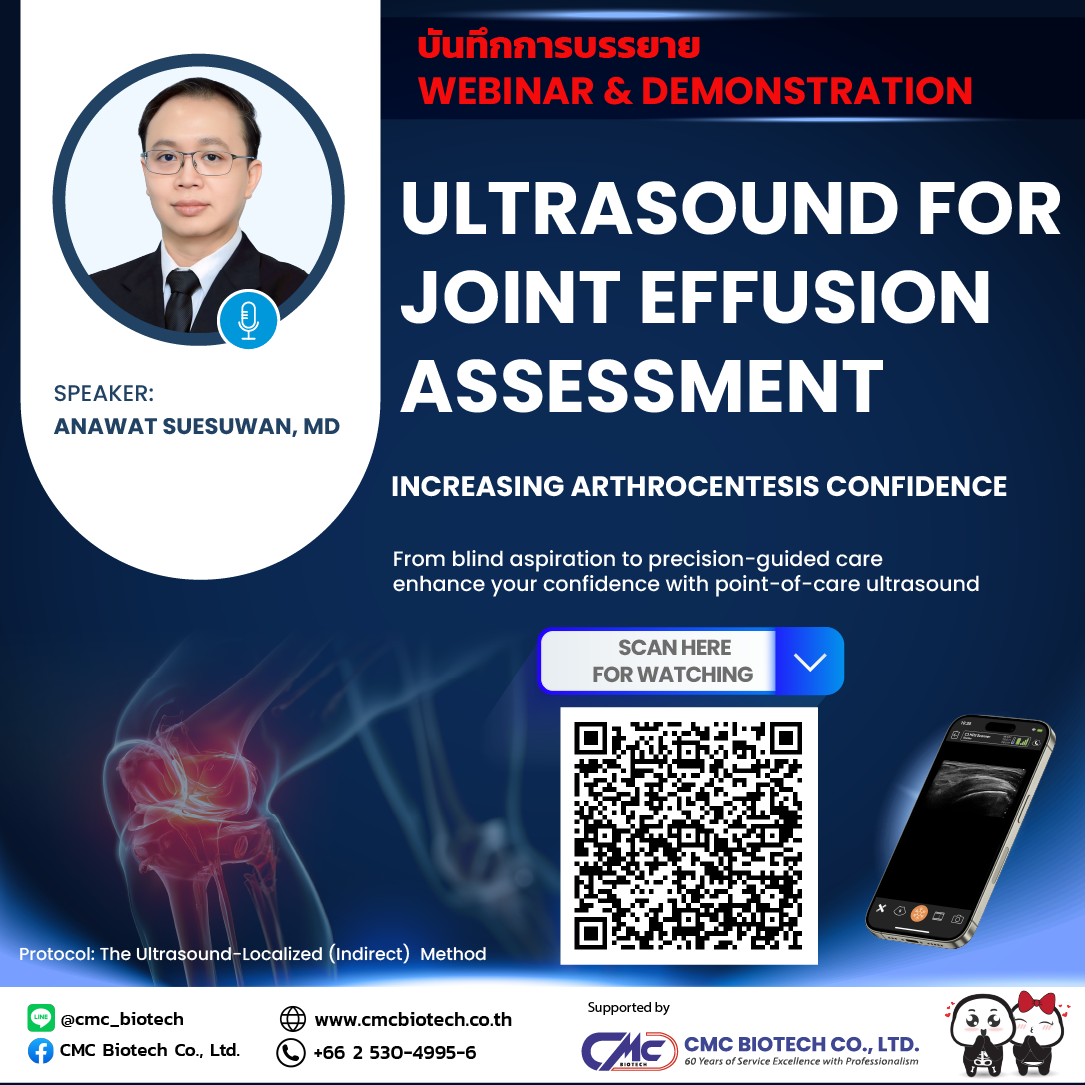 Recorded Webinar | Ultrasound for Joint Effusion Assessment 20 May 2026