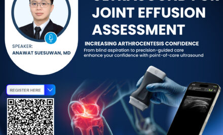 Recorded Webinar | Ultrasound for Joint Effusion Assessment 20 May 2026